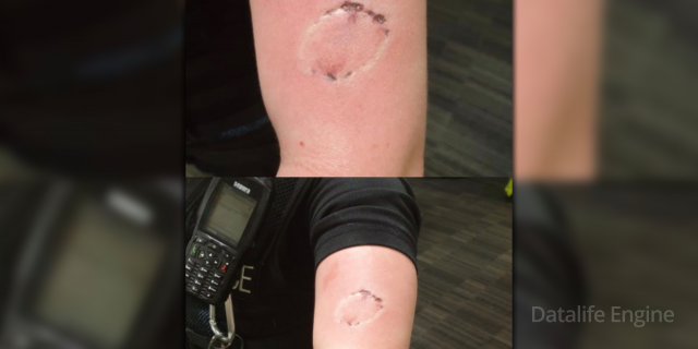 ხაშურში დასაჯარიმებლად მისული პატრული ადგილობრივმა ქალმა დაკბინა