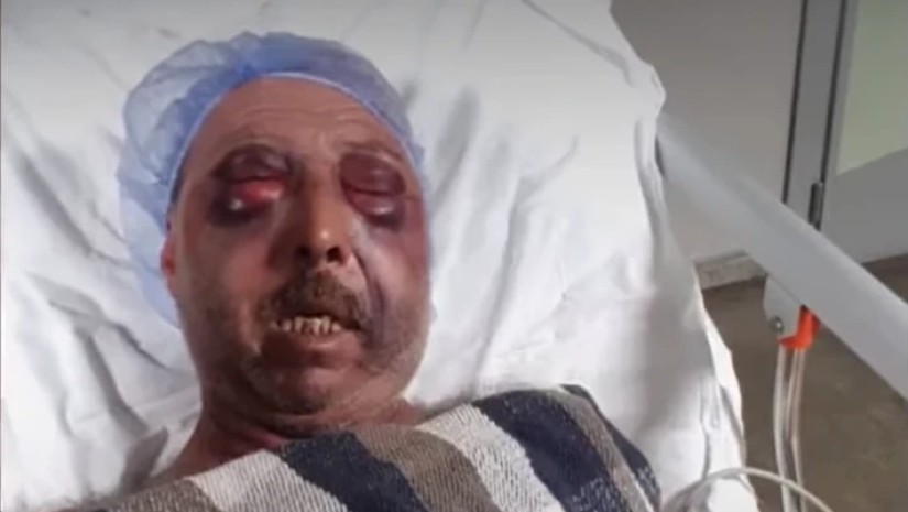 დიდი ცემა-ტყეპა ქორწილში - გარდაბანში სიძე-პატარძლის ნათესავები ერთმანეთს სასტიკად გაუსწორდნენ