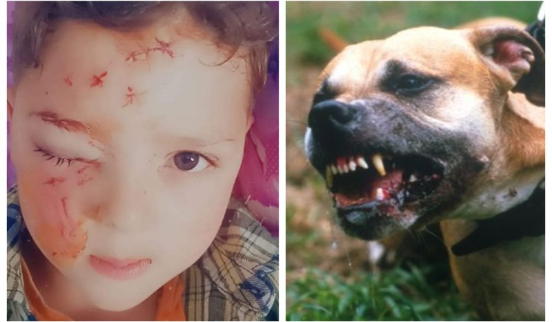 "უპატრონო ძაღლმა ეს დამართა ჩემს გაბრიელს, ლამის შემიჭამა ბავშვი...ხალხო, ამოიღეთ ხმა"