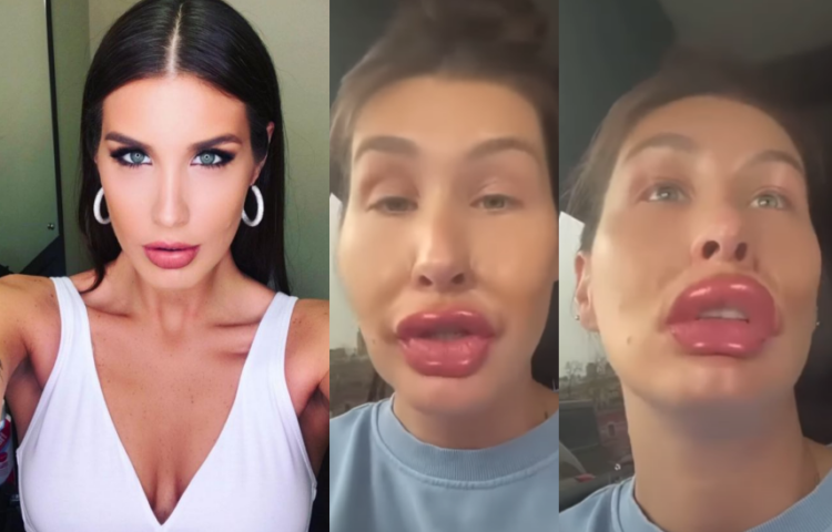 ”ცოტა ფილერი გავიკეთე სახეზე და ტუჩზე” – ქეთა თოფურიას ვიდეოს დიდი გამოხმაურება მოჰყვა