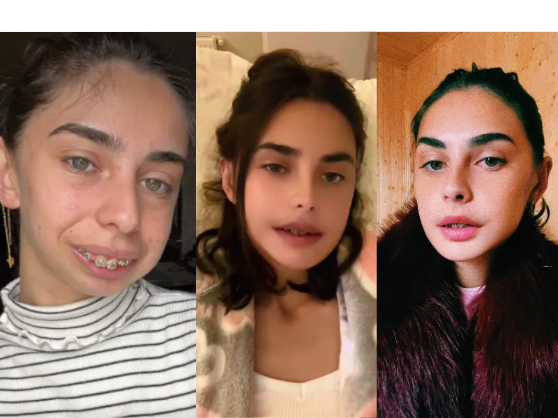 "ლილიანას ოპერაციიიდან 15 დღე გავიდა დღეს..." - დანტესი ლილიანას ახალ კადრებს აქვეყნებს